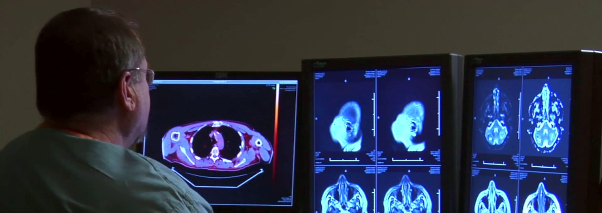 Beskrivende bilde relatert til innholdet i filmen "Menneskekroppen - hjernen og nervesystemet"